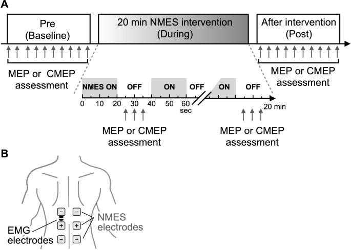 Upper Extremity & Trunk Neuromuscular Electrical Stimulation