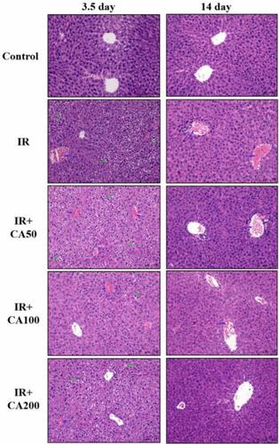 Correction to: Amelioration of radiation‑induced liver damage by p ...