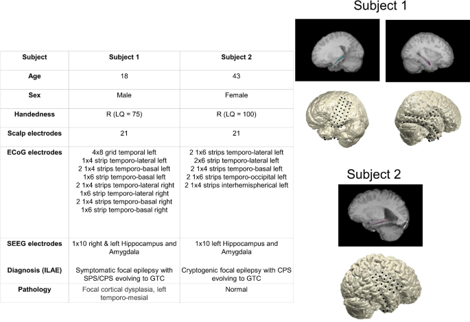 Electrocorticographic Activation Patterns of