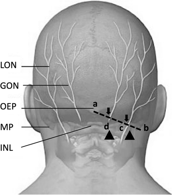 the-occipital-nerves-applied-strain-test-to-support-occipital-neuralgia