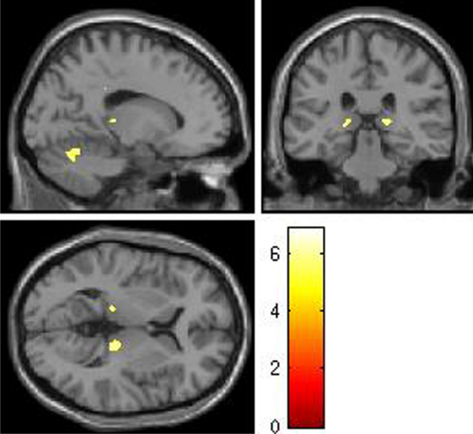 experimental brain research if