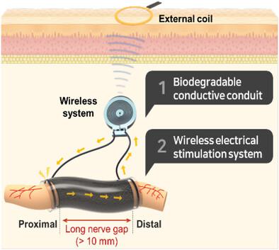 An implantable electrical stimulator used for peripheral nerve  rehabilitation in rats