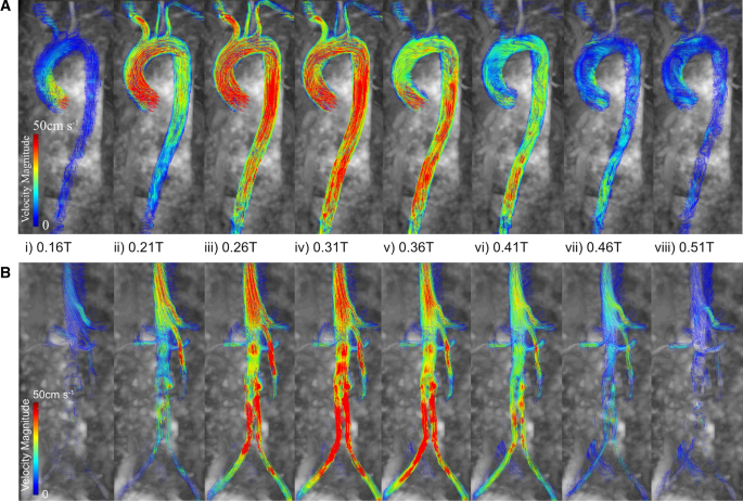 Reconstruction and Validation of Arterial Geometries for Computational ...