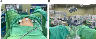 Comparison Of Senhance And Da Vinci Robotic Radical Prostatectomy ...