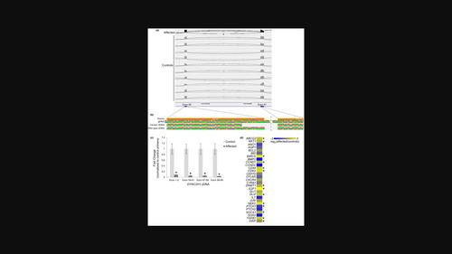 RNA sequencing resolves novel DYNC2H1 variants causing short-rib ...