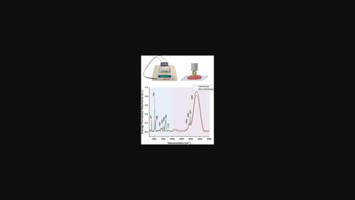 Fiber Optic Probe-based ATR-FTIR Spectroscopy For Rapid Breast Cancer ...