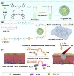 An Injectable Nanocomposite Hydrogel Prevents Postoperative Tumor ...