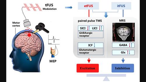 经颅聚焦超声刺激对人体运动皮层的兴奋-抑制调节,CNS Neuroscience 