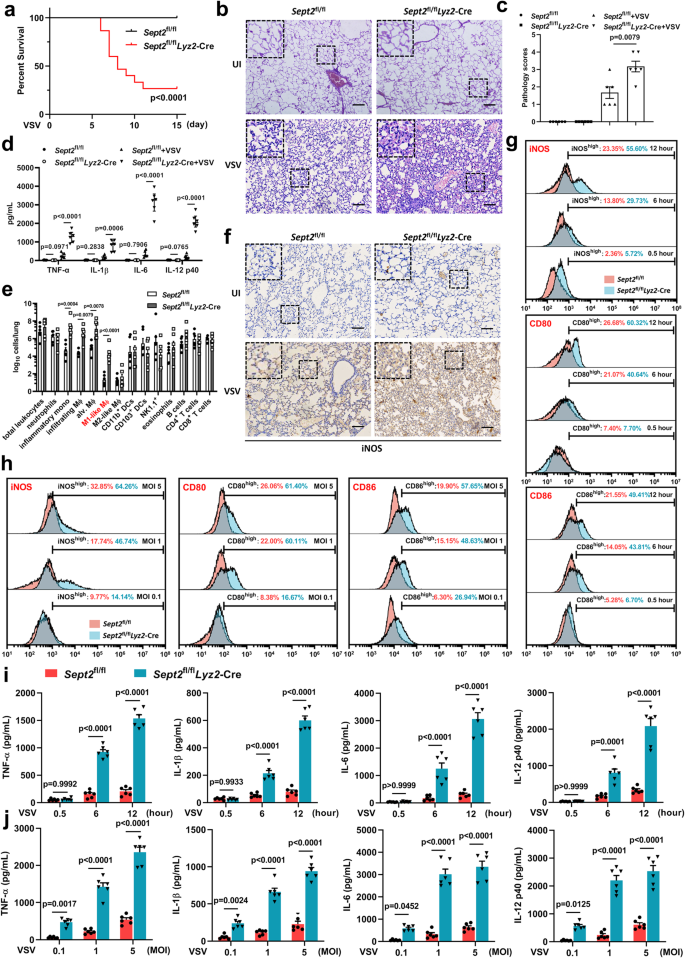 SEPTIN2 Suppresses An IFN-γ-independent, Proinflammatory Macrophage ...