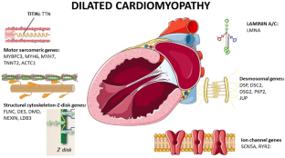 Multidisciplinary approach in cardiomyopathies From genetics to