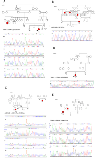 Whole Exome Sequencing Identifies Novel Pathogenic Variants In TGM1 And ...