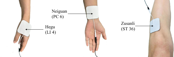 Effect Of Transcutaneous Electrical Acupoint Stimulation On ...