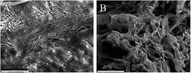 Characteristics and mechanisms of resorption in lumbar disc