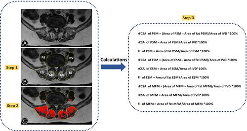 Fatty Infiltration of Multifidus Muscles: An Easily Overlooked Risk ...