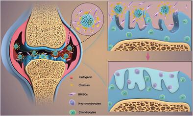 Stem Cells Expansion Vector via Bioadhesive Porous Microspheres for  Accelerating Articular Cartilage Regeneration,Advanced Healthcare Materials  - X-MOL