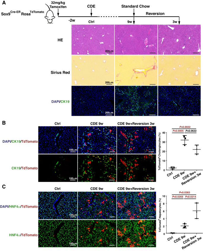 GITRL impairs hepatocyte repopulation by liver progenitor cells to ...