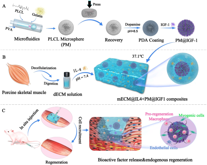 Elastic porous microspheres/extracellular matrix hydrogel injectable ...