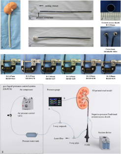 The optimal ratio of endoscope sheath diameter with negative  