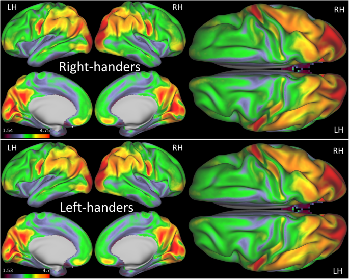 Associations Between Handedness And Brain Functional Connectivity