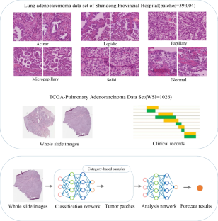 A Novel Transformer-based Aggregation Model For Predicting Gene ...