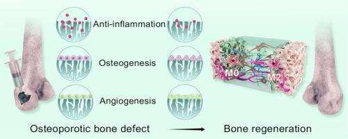 Injectable, anti-collapse, adhesive, plastic and bioactive bone graft ...