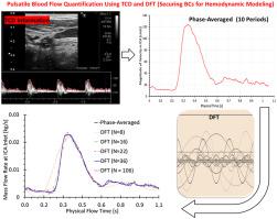 Using DFT on ultrasound measurements to determine patient-specific ...