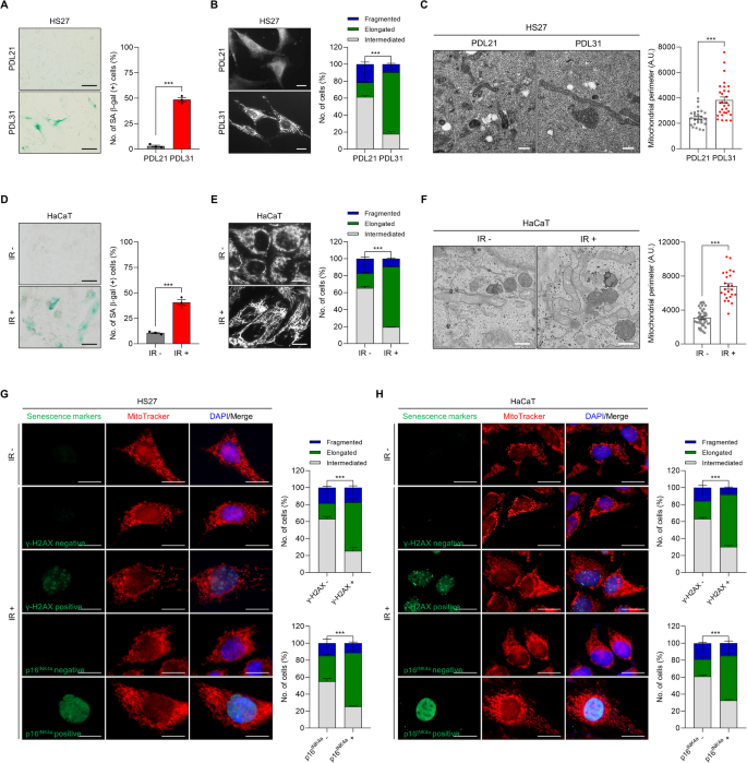 miR-30-5p/TIA-1轴通过调节线粒体动力学来指导细胞衰老,Cell Death & Disease - X-MOL