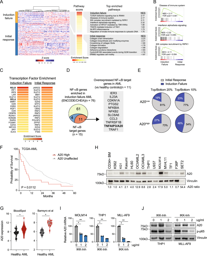 Chemotherapy resistance in acute myeloid leukemia is mediated by A20