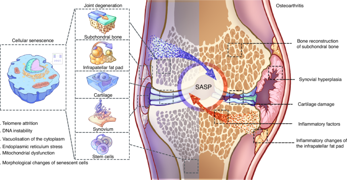 Cross Talk Of Inflammation And Cellular Senescence A New Insight Into