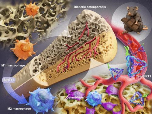 Gene Activating Framework Nucleic Acid Targeted Upregulating Sirtuin To Modulate Osteoimmune