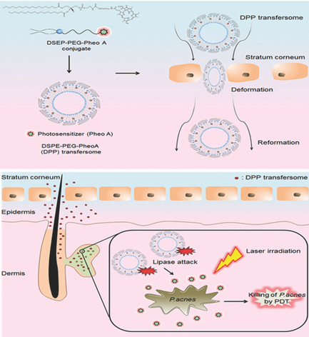 Phd photodynamic therapy thesis