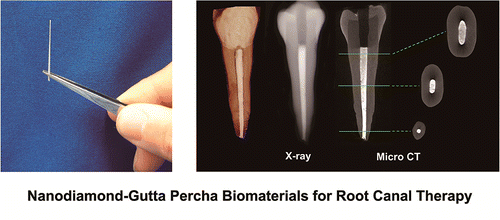 用于根管治疗的纳米金刚石-古塔胶复合生物材料,ACS Nano - X-MOL