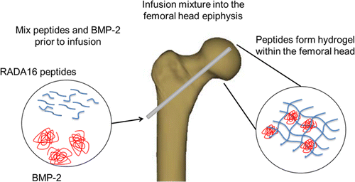 Intraosseous Delivery of Bone Morphogenic Protein-2 Using a Self ...