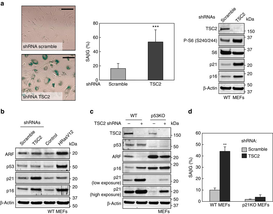 Stabilization of p21 by mTORC1/4E-BP1 predicts clinical outcome of head ...
