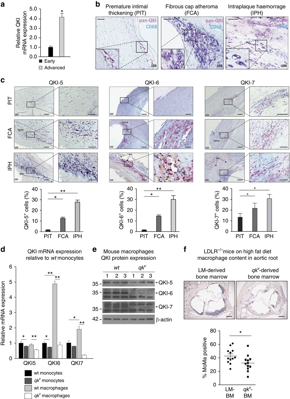 Quaking promotes monocyte differentiation into pro-atherogenic ...