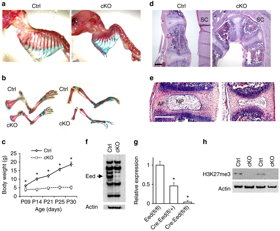 Polycomb repressive complex 2 regulates skeletal growth by suppressing ...