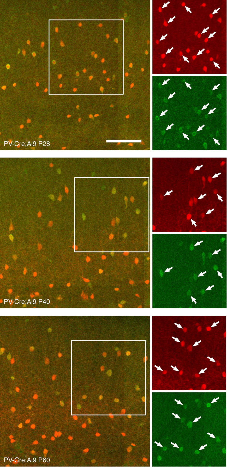 pten-and-ephb4-regulate-the-establishment-of-perisomatic-inhibition-in
