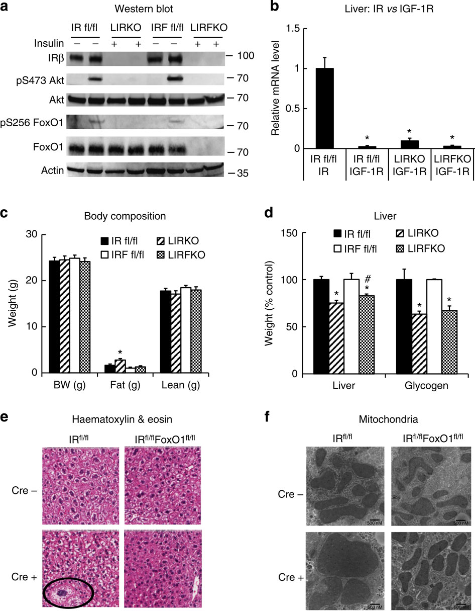 FoxO1 integrates direct and indirect effects of insulin on hepatic ...