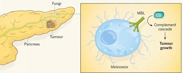 自然 引起头皮屑的真菌促进 癌王 生长 科学家发现 马拉色菌属真菌在胰腺癌组织中暴增数千倍 促进胰腺癌生长 X Mol资讯