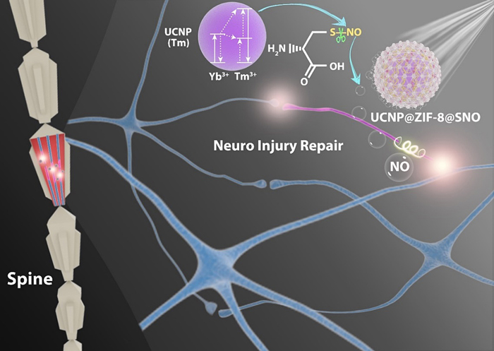 Sci Adv 一氧化氮气体分子多效信使策略用于神经损伤的高效修复 X Mol资讯