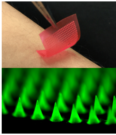 微针贴片局部递送肿瘤免疫检查点抑制剂